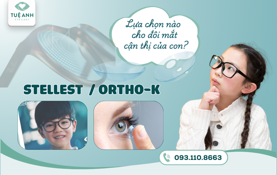 Ortho-K hay Stellest? Lựa  chọn phương pháp nào cho đôi mắt cận thị của con?