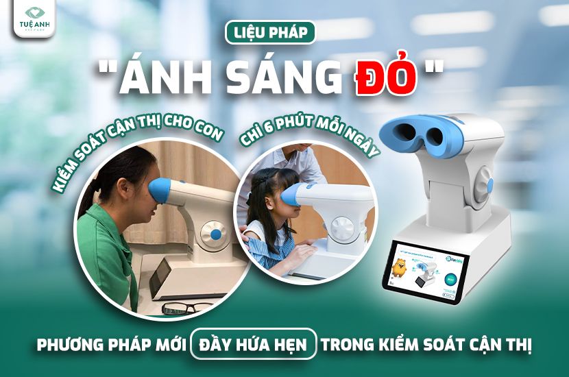 Liệu pháp ánh sáng đỏ - phương pháp mới đầy hứa hẹn trong kiểm soát cận 