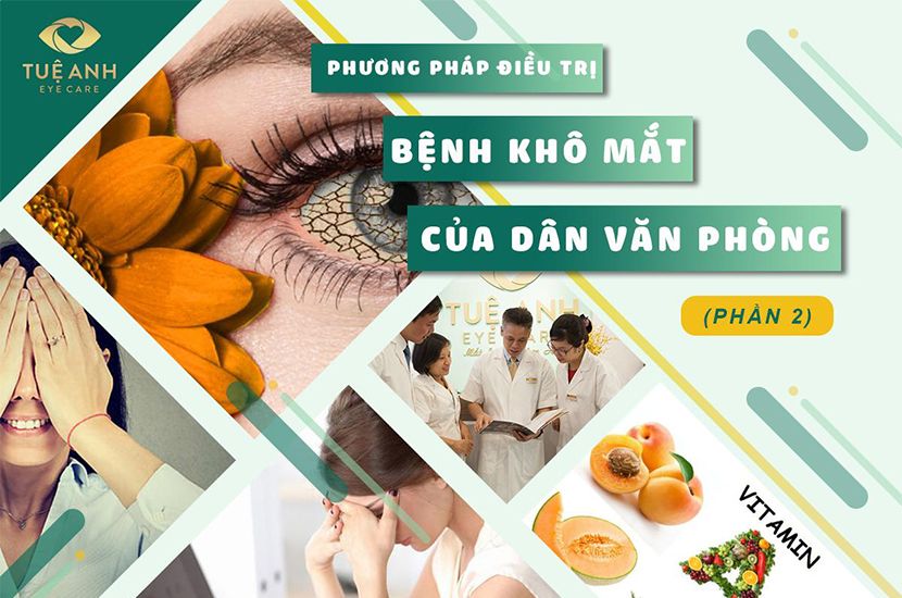 BỆNH KHÔ MẮT CỦA DÂN VĂN PHÒNG (P1)