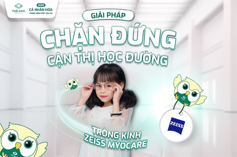 Tròng kính kiểm soát cận thị Zeiss - Giải pháp cá nhân hóa cho từng đôi mắt
