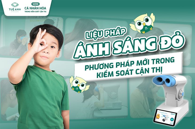 Ứng dụng Ánh Sáng Đỏ trong Kiểm Soát Cận Thị – Cá Nhân Hóa Theo Trục Nhãn Cầu