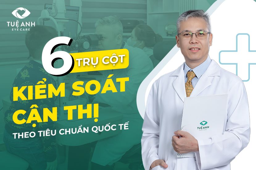 6 trụ cột vàng trong kiểm soát cận thị ở trẻ – Ba mẹ đã biết chưa?