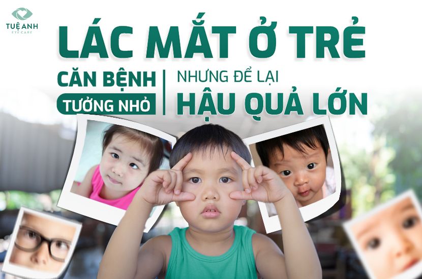 Lác mắt ở trẻ em: Căn bệnh tưởng nhỏ, hậu quả không nhỏ