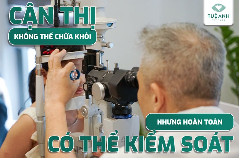 Cận Thị Không Chữa Khỏi Được – Nhưng Hoàn Toàn Có Thể Kiểm Soát!