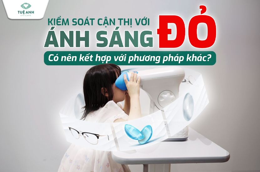 Kiểm soát cận thị bằng ánh sáng đỏ – có nên kết hợp với phương pháp khác?   