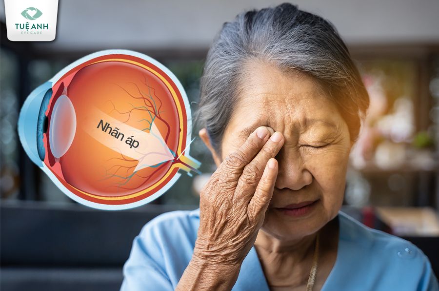 Bệnh Glôcôm – Ai có nguy cơ cao mắc?