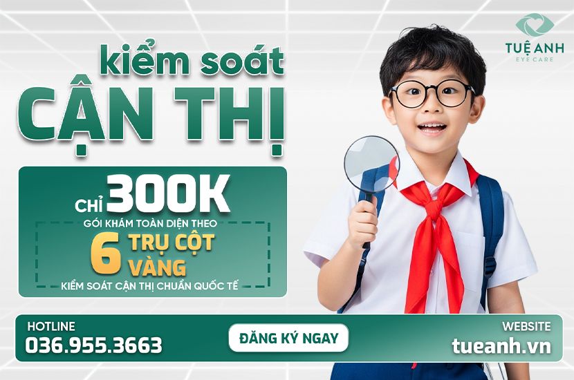Chỉ 300K – Gói Khám Kiểm Soát Cận Thị Chuẩn Quốc Tế Tại Phòng Khám Mắt Tuệ Anh