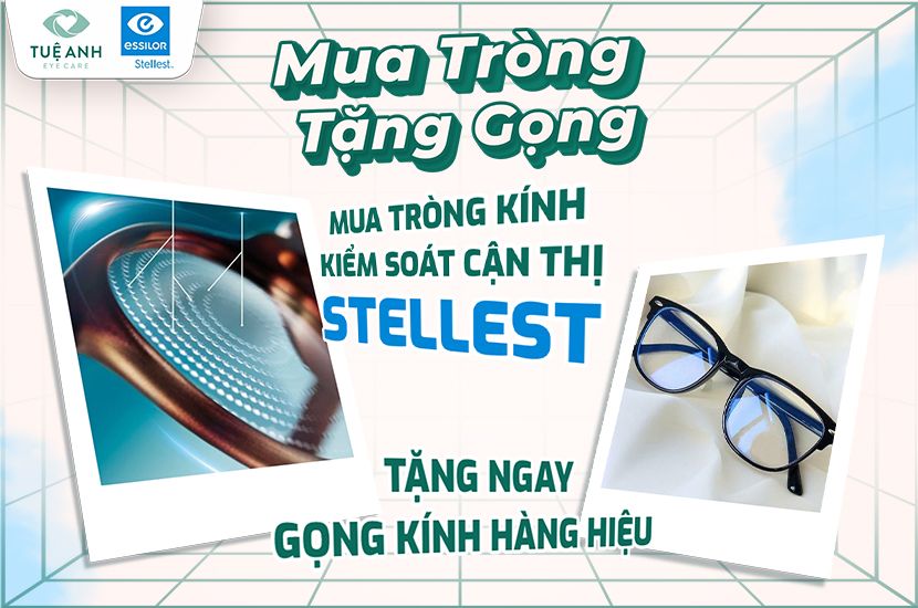 Ưu đãi đặc biệt: Mua tròng Stellest – Tặng gọng cao cấp tại Mắt Tuệ Anh