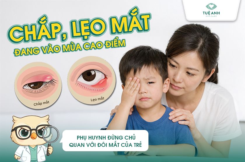 Chắp - lẹo ở trẻ em: Dấu hiệu nhận biết và cách xử lý an toàn tại nhà 