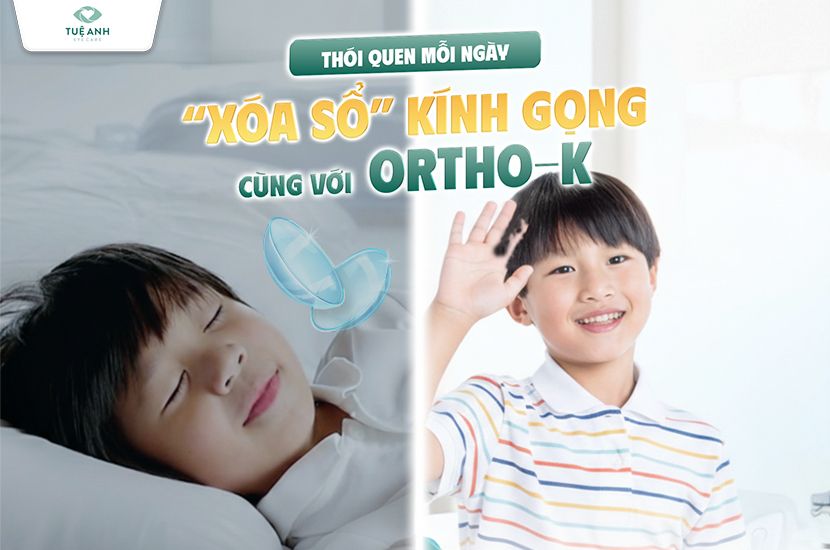 Thói quen mỗi ngày “xoá sổ” kính gọng cùng cách sử dụng kính Ortho-K chuẩn y khoa 