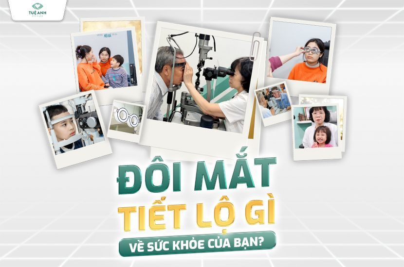 Đôi mắt tiết lộ gì về sức khỏe? Những dấu hiệu bệnh lý qua mắt cần lưu ý 