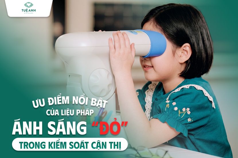 Ưu điểm nổi bật của liệu pháp ánh sáng đỏ trong kiểm soát cận thị 