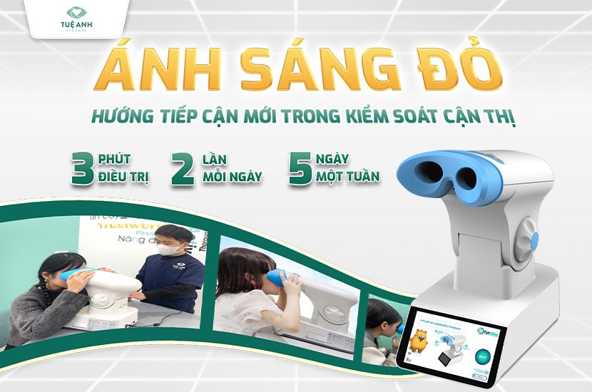 Liệu pháp ánh sáng đỏ - Hướng tiếp cận mới trong kiểm soát cận thị