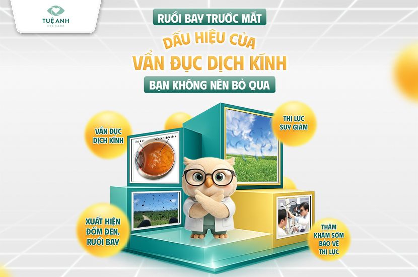 Dấu hiệu của vẩn đục dịch kính bạn không nên bỏ qua