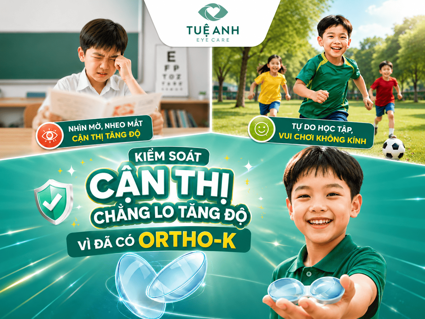 Phương pháp Ortho-k: Giải pháp kiểm soát cận thị không phẫu thuật 