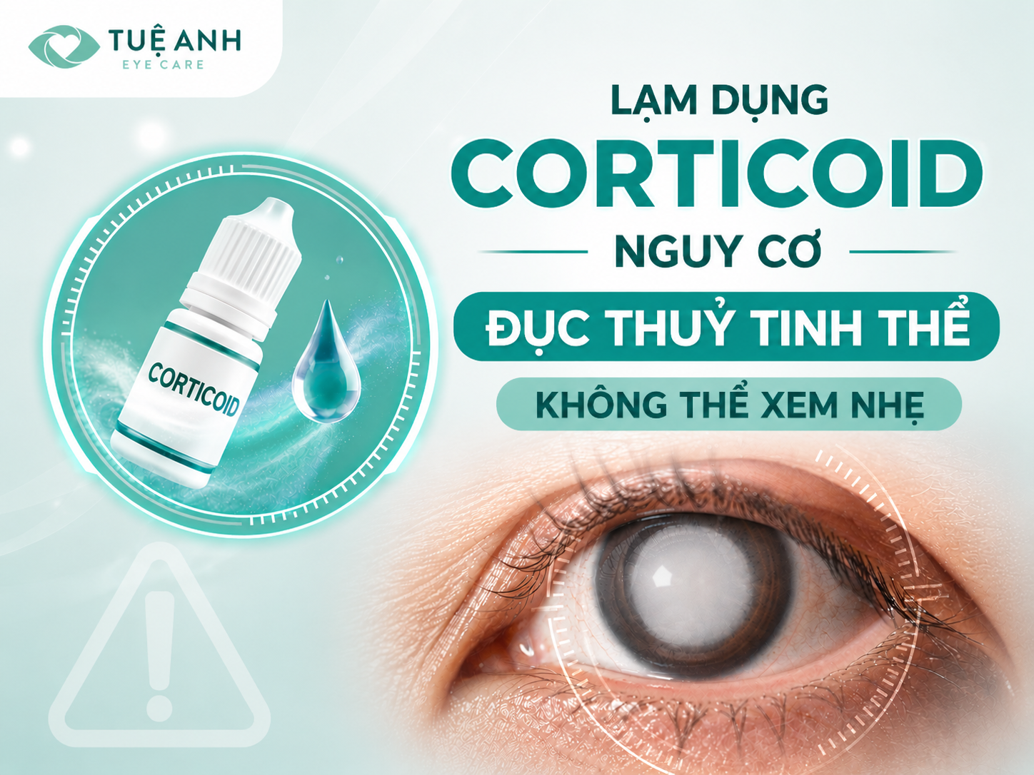 Lạm dụng Corticoid - Nguy cơ đục thuỷ tinh thể sớm không thể xem nhẹ 
