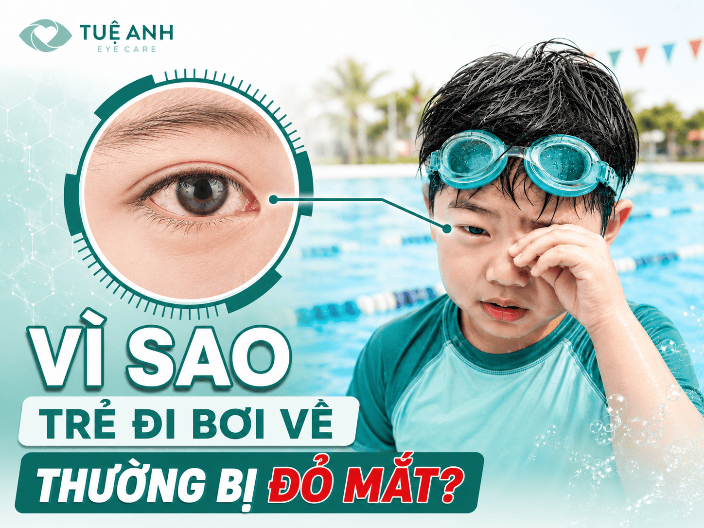 Vì sao trẻ đi bơi về thường bị đỏ mắt?