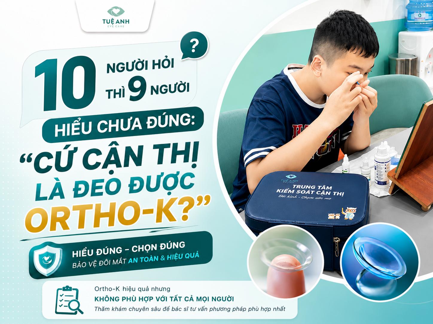 Có phải cứ cận thị là đeo được kính Ortho-k?