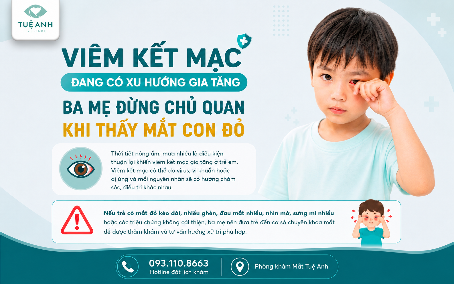 Viêm kết mạc đang có xu hướng gia tăng: Tìm hiểu nguyên nhân, triệu chứng và cách xử trí an toàn