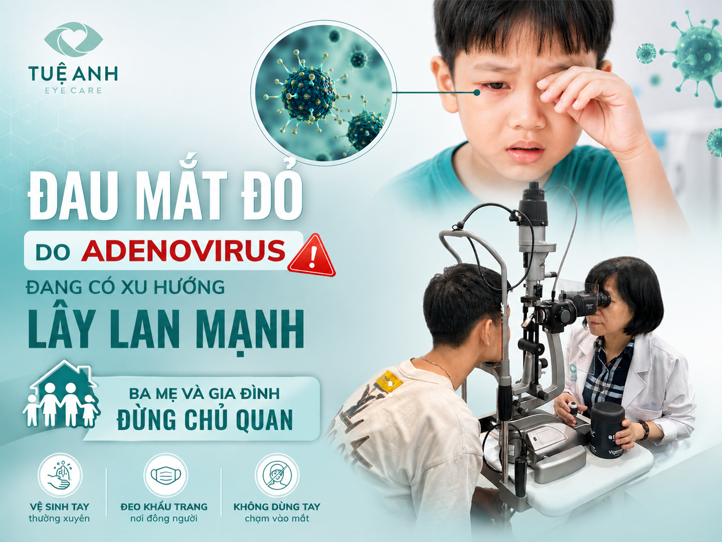 Đau mắt đỏ do Adenovirus đang bùng phát: Nguyên nhân, triệu chứng à cách phòng lây nhiễm